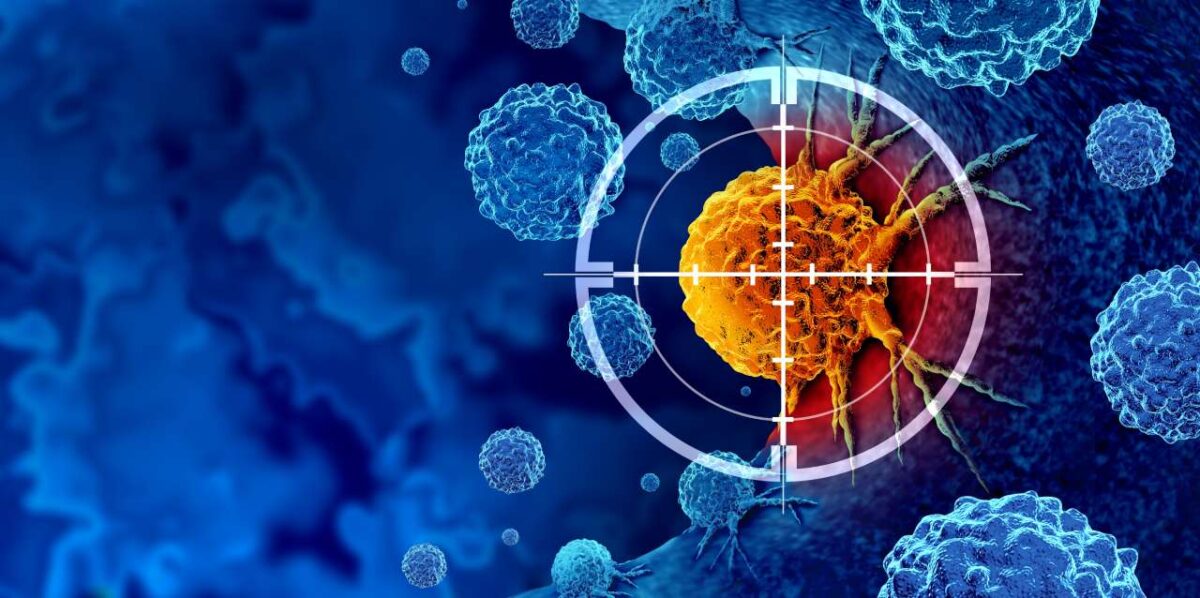 ¿Cuáles exámenes ayudan detectar el cáncer de forma temprana?