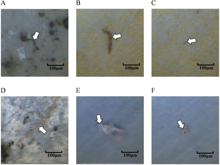 Microplásticos en el pulmón humano. (Jenner et al., Science of the Total Environment, 2022).