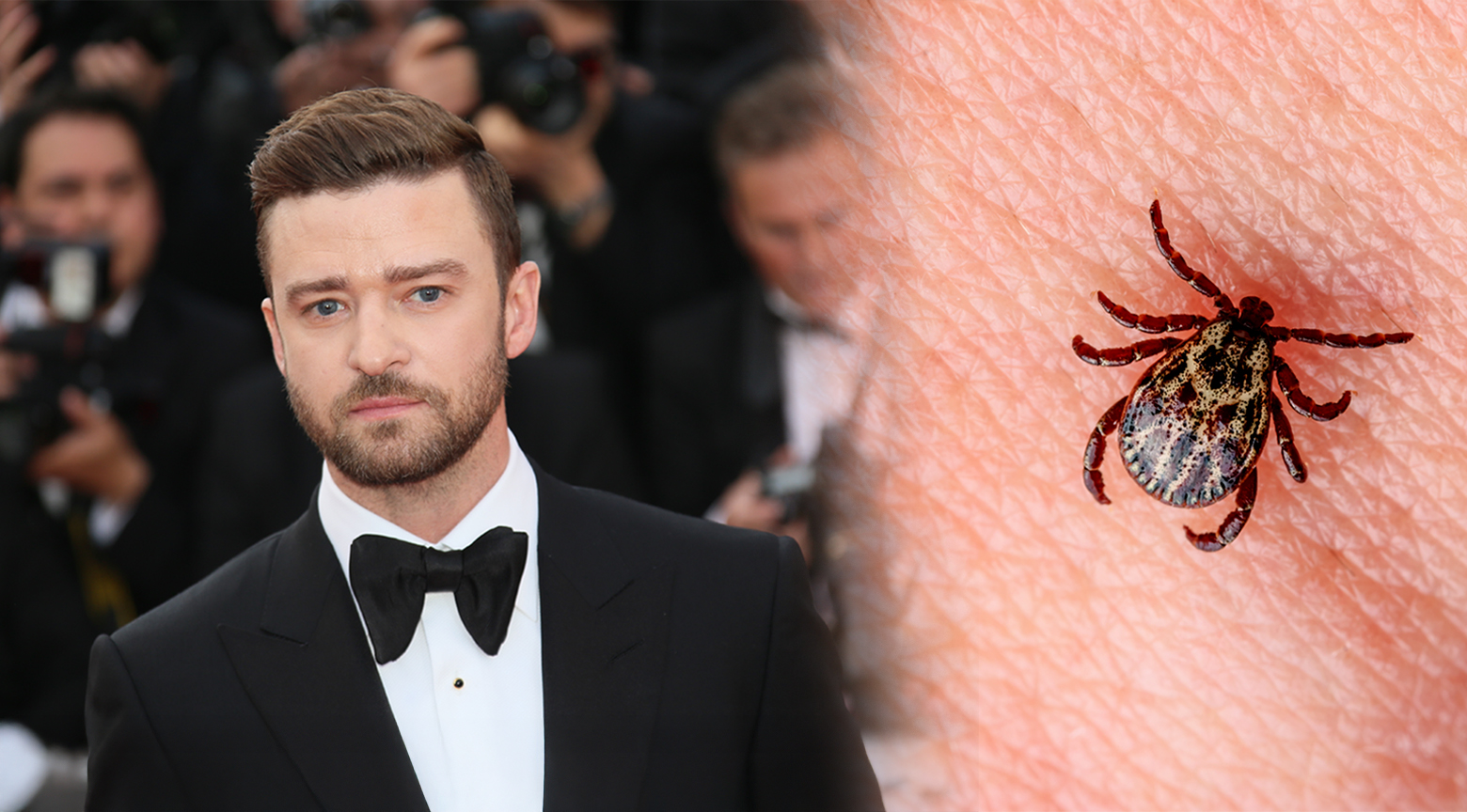 ¿Qué es la enfermedad de Lyme que Justin Timberlake trae?