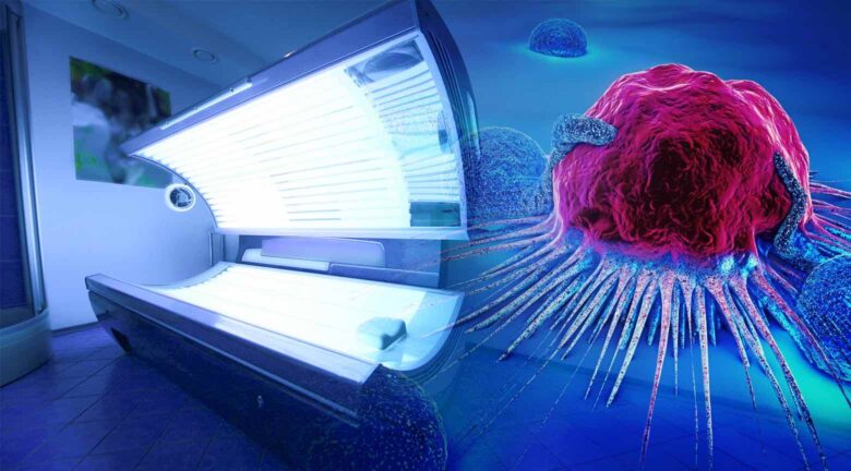 Camas solares envejecen el ADN y elevan riesgo de cáncer 