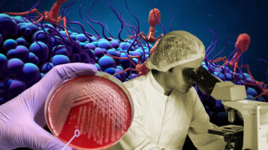 Científicos hallan el «talón de Aquiles» de una de las superbacterias
