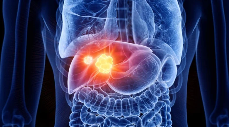 Hígado graso: Las señales de alerta que tu cuerpo envía y podrías estar ignorando