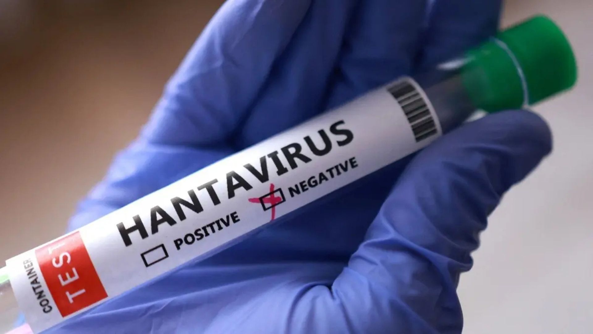 Muestra de laboratorio identificada como hantavirus sostenida por una mano con guante médico azul.
