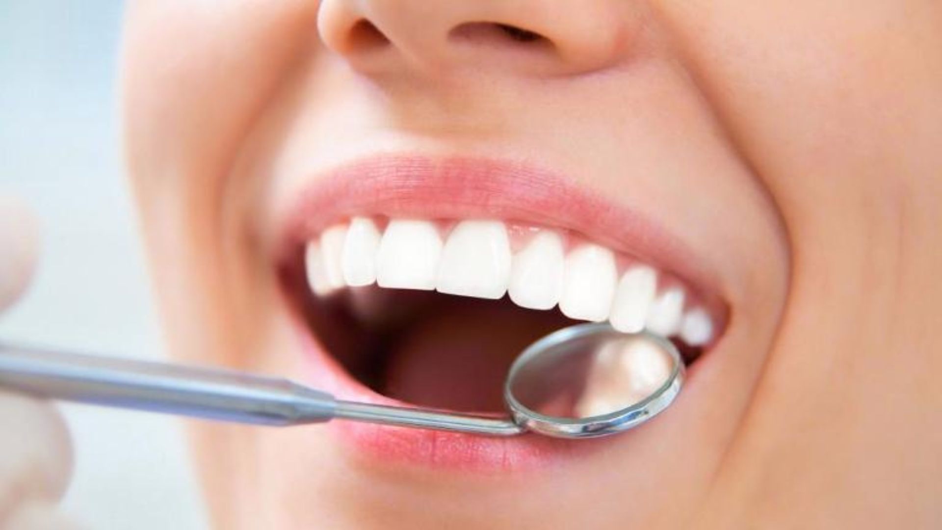 Primer plano de una persona durante una revisión dental mientras un odontólogo utiliza un espejo clínico para examinar sus dientes.