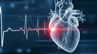 Los primeros síntomas de un ataque cardíaco que el cuerpo envía días antes, según la Cleveland Clinic