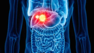 ¿Qué fruto ayuda a reducir la grasa en el hígado según Cleveland Clinic?
