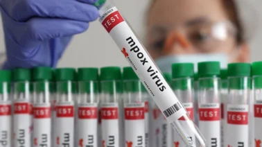 Alerta epidemiológica en RD: Salud Pública confirma transmisión activa de Mpox con 9 casos