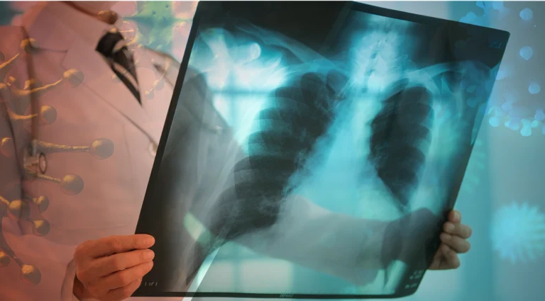 Virus respiratorios en República Dominicana: Salud Pública alerta sobre la circulación de COVID-19 e Influenza