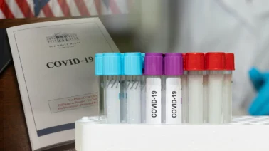 ¿Fuga de laboratorio? El revelador informe de la Casa Blanca sobre el verdadero origen del COVID-19