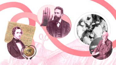 Historia del cáncer de mama